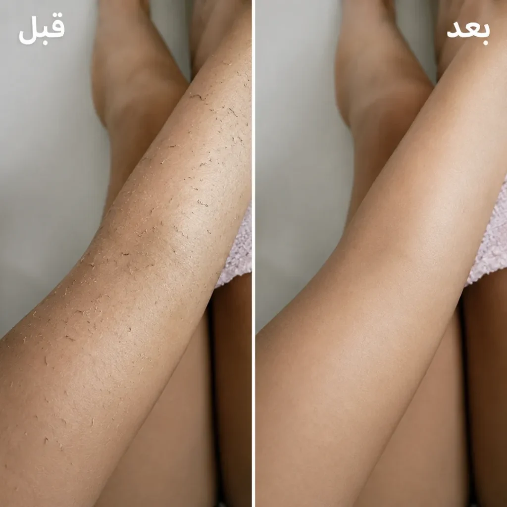 قفازين تقشير باث قلوي